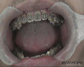 舌体视频,探寻人体语言奥秘